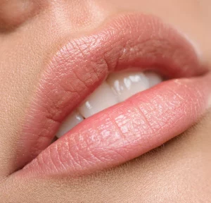 Lip fillers