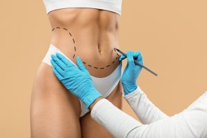 Lipolysis